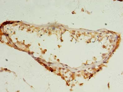 Polyclonal Rabbit anti-Human NUDT11 Antibody (IHC, WB)