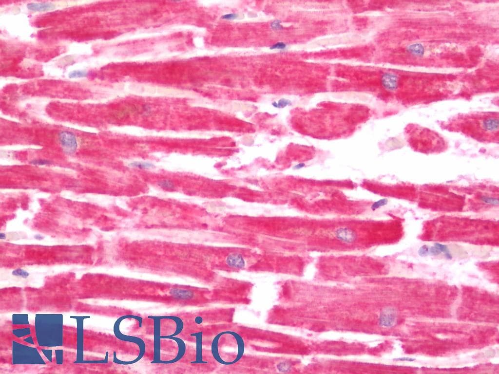 IHC-plus™ SDR9C1 / BDH1 Antibody (aa47-343)