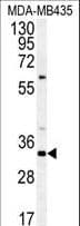 CCDC101 Antibody (aa179-208)