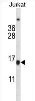 BCL2 / Bcl-2 Antibody (aa86-114)
