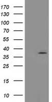 Monoclonal Mouse anti-Human TOMM34 Antibody (clone OTI 2E11, WB)