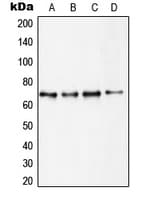 RPS6KB1 / P70S6K / S6K Antibody (C-Terminus)