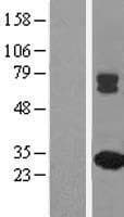 MMAB Protein (Over-Expression Lysate Myc-DDK (Flag))