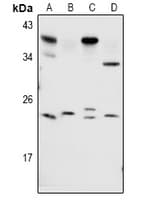 Polyclonal Rabbit anti-Human RAB1B Antibody (WB)