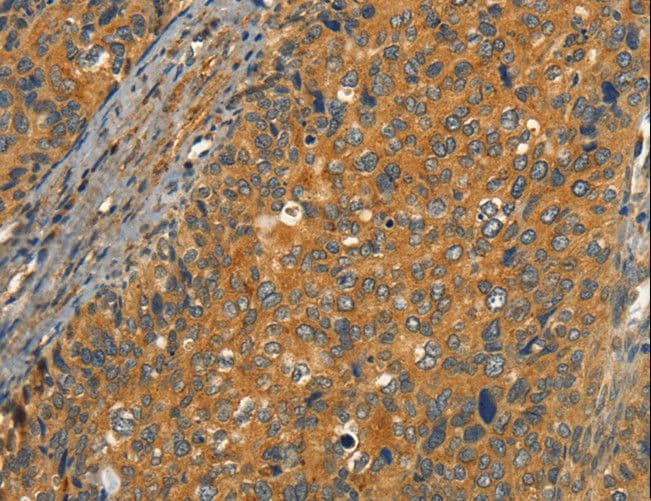 CIB1 / KIP Antibody
