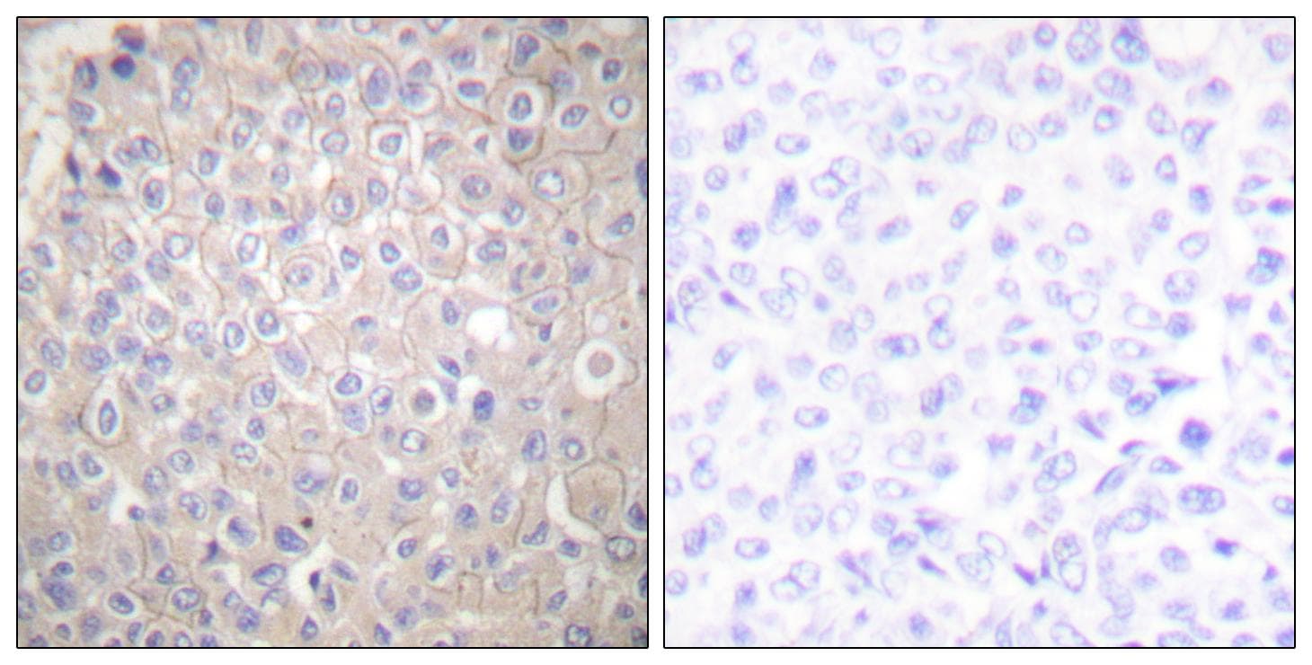 CDH1 / E Cadherin Antibody