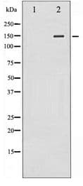 PLCG2 / PLC Gamma 2 Antibody