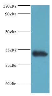 Polyclonal Rabbit anti-Human UCP1 / UCP-1 Antibody (aa1-307, IHC, WB)