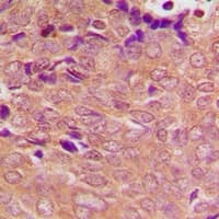 PSMC3 Antibody (Internal)