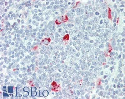 IHC-plus™ NLRP12 Antibody (aa183-212)