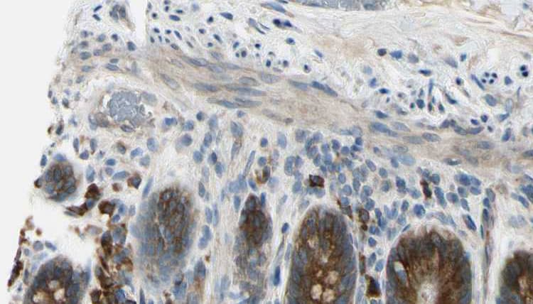 SEMA4A / Semaphorin 4A Antibody