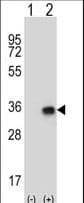 CNOT8 Antibody (aa33-60)