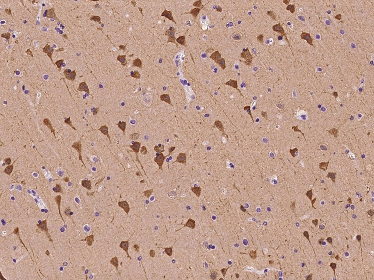 Polyclonal Rabbit anti-Human NRGN / Neurogranin Antibody (IHC)