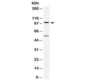 FGFR1 / FGF Receptor 1 Antibody