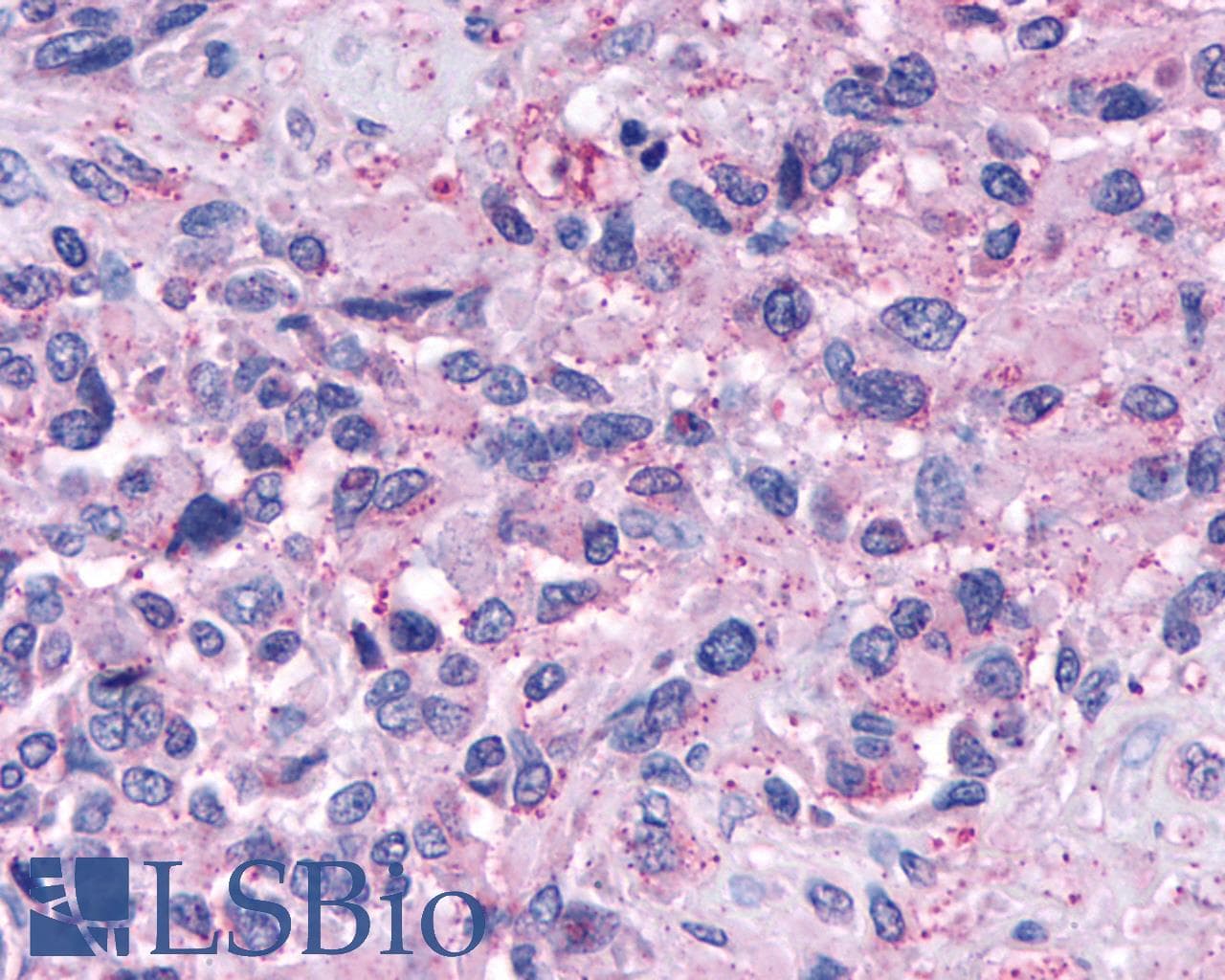 PathPlus™ NPY4R / PPYR1 Antibody (Extracellular Domain)