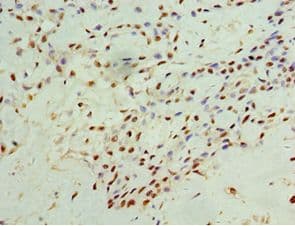 CD119 / IFNGR1 Antibody (aa270-489)
