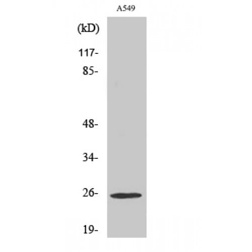 Polyclonal Rabbit anti-Human ARHGDIG / RHOGDI-3 Antibody (110-190 aa, Internal, WB)