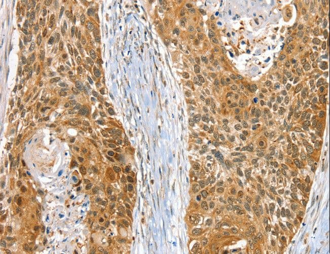 RAB27A / RAB27 Antibody