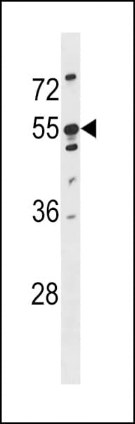 KRT86 / Keratin 86 / KRTHB6 Antibody (aa300-327)