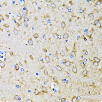 Polyclonal Rabbit anti-Human MAP1LC3B / LC3B Antibody (IHC, WB)