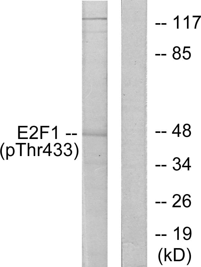 E2F1 Antibody (phospho-Thr433)