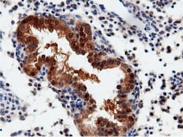QPRT Antibody (clone OTI7A8)