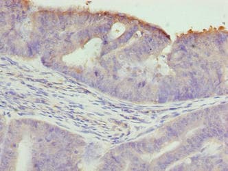 Polyclonal Rabbit anti-Human TTC30A Antibody (IHC, WB)