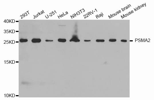 Polyclonal Rabbit anti-Human PSMA2 Antibody (IHC, IF, WB)