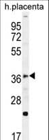 FOXI1 Antibody (aa224-253)