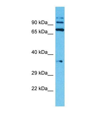 TMPRSS7 Antibody (N-Terminus)