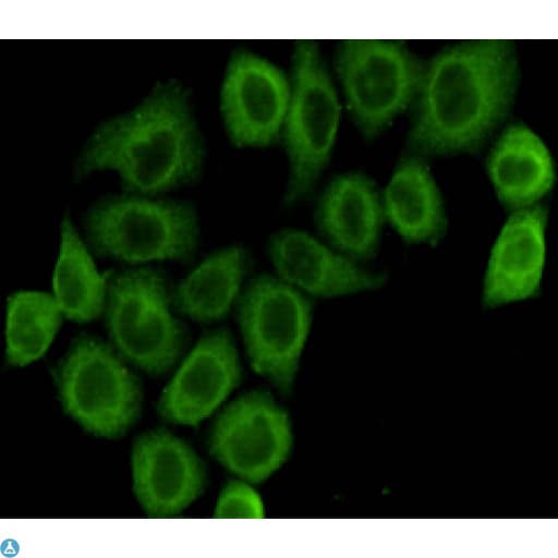 Monoclonal Mouse anti-Human PDHA1 / PDH E1 Alpha Antibody (WB)