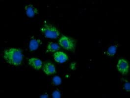 Monoclonal Mouse anti-Human CALCOCO2 Antibody (clone OTI2D11, IF, WB)