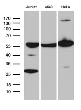 IHC-plus™ Monoclonal Mouse anti-Human PTBP3 / ROD1 Antibody (clone OTI5C9, aa300-552, IHC, WB)