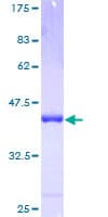 Human E48 / LY6D Protein (Recombinant GST)