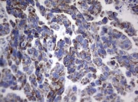 Monoclonal Mouse anti-Human PIK3CD / PI3K Delta Antibody (clone OTI1B5, aa286-610, IHC, WB)