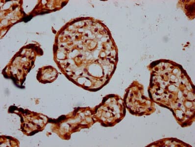 Polyclonal Rabbit anti-Human STT3B Antibody (IHC)