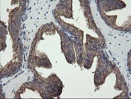 REEP5 Antibody (clone OTI4D2)
