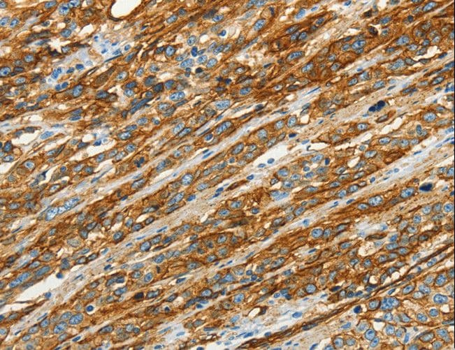CAV1 / Caveolin 1 Antibody