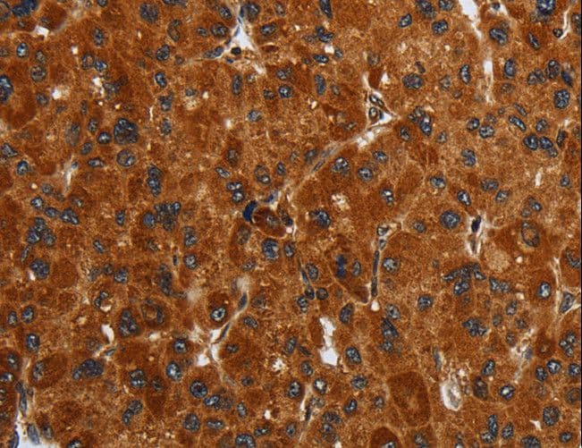 ENTPD7 Antibody