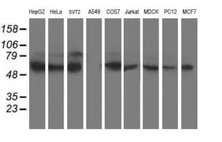 Monoclonal Mouse anti-Human XPNPEP3 Antibody (clone OTI4B8, IHC, IF, WB)