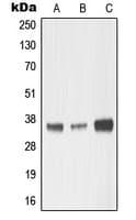 MMP23 Antibody (Internal)