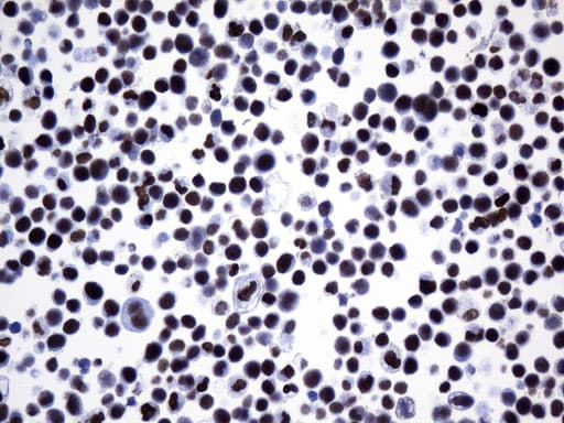 FOXP1 Antibody (clone UMAB242, Carrier-free)