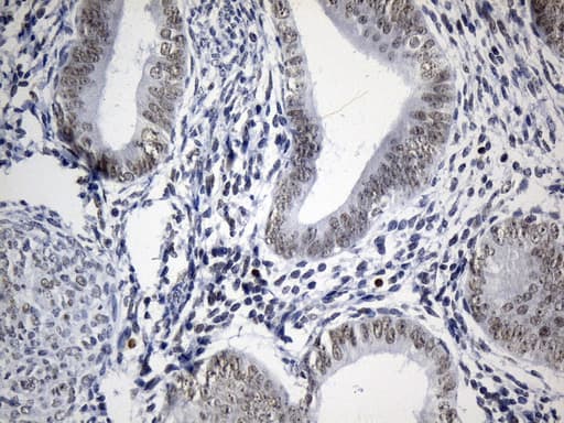 FOXP1 Antibody (clone UMAB242)