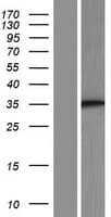 ST3GAL3 / ST3N Protein (Over-Expression Lysate Myc-DDK (Flag))
