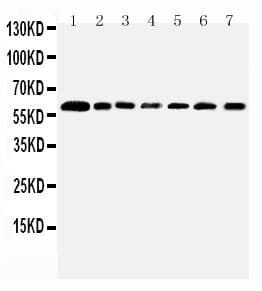 PRMT4 / CARM1 Antibody (aa267-284)
