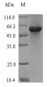 Wheat Serpin-Z1B Protein (Recombinant 6His-SUMO, N-terminus)