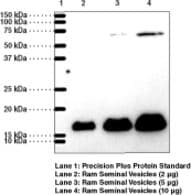 IHC-plus™ Polyclonal Rabbit anti-Human PGES / PTGES Antibody (IHC, WB)