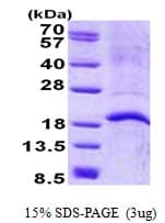 Human LL37 / Cathelicidin Protein (Recombinant His)