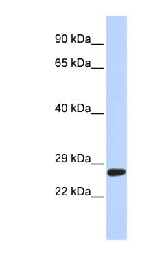 SETD4 Antibody (C-Terminus)