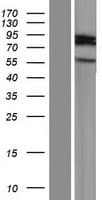 ARHGAP40 Protein (Over-Expression Lysate Myc-DDK (Flag))